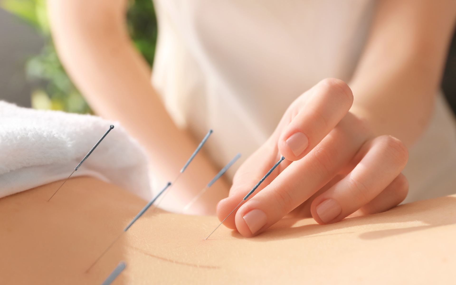 Introduction to acupuncture